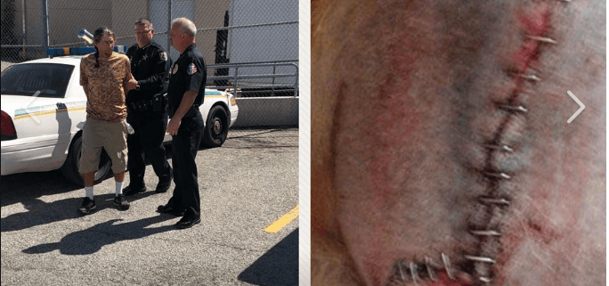 Groomer arrested for injuring a service dog